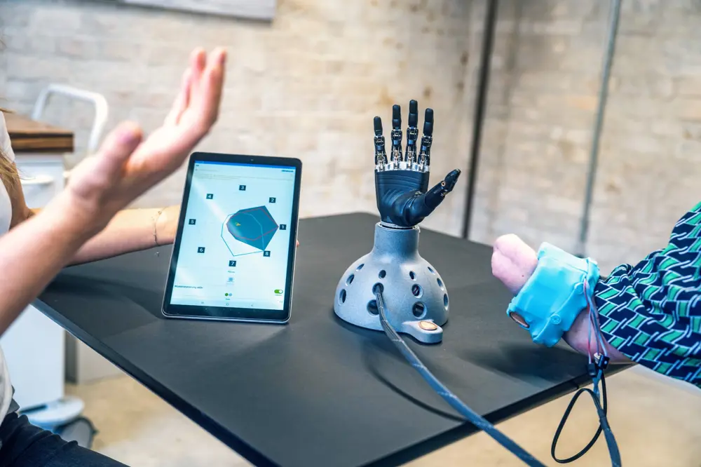 A person wearing a sensor on their residual limb, to calibrate their arm muscles' electrical signals for a myoelectric prosthesis